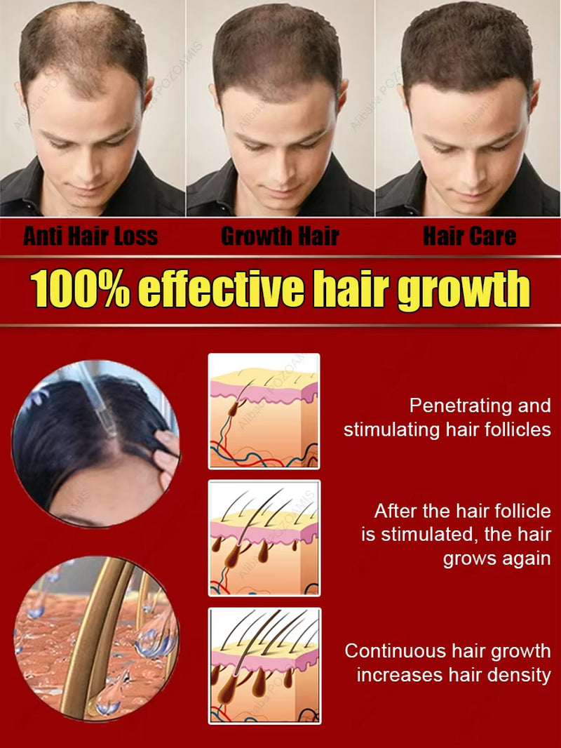 98% of Buyers Buy Again, Have More and More Hair, Say Goodbye to Baldness, Thick Hair,Hot Selling Product.