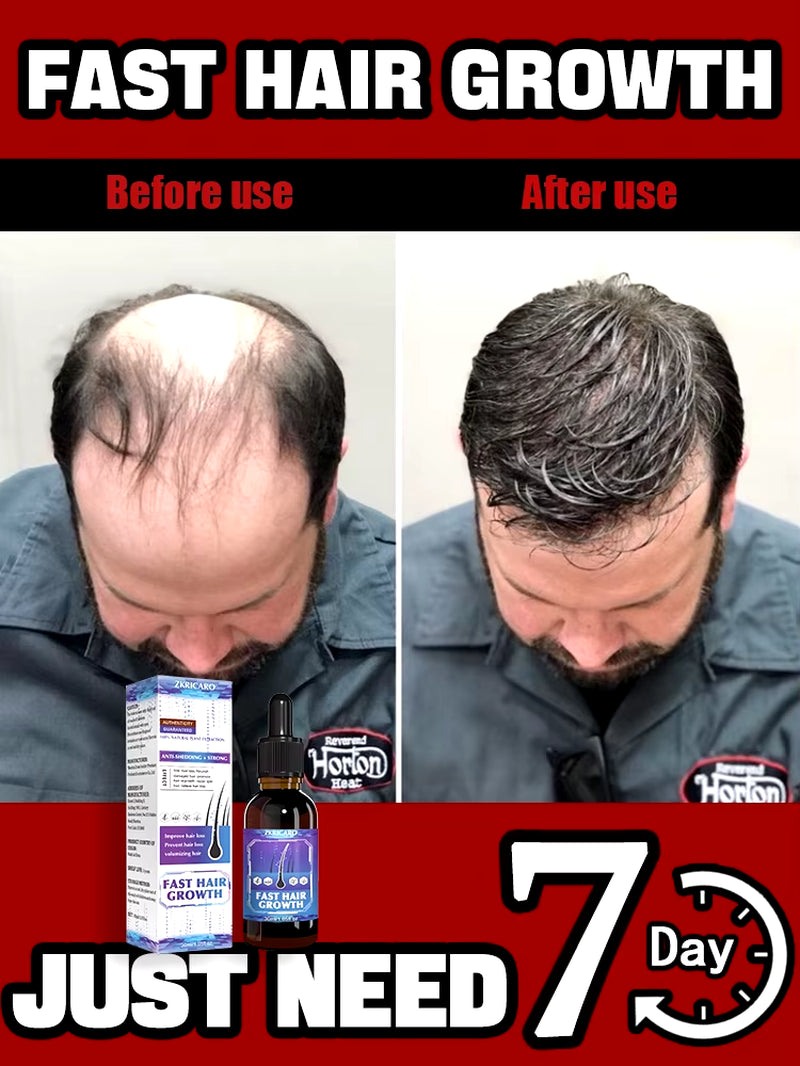 98% of Buyers Buy Again, Have More and More Hair, Say Goodbye to Baldness, Thick Hair,Hot Selling Product.