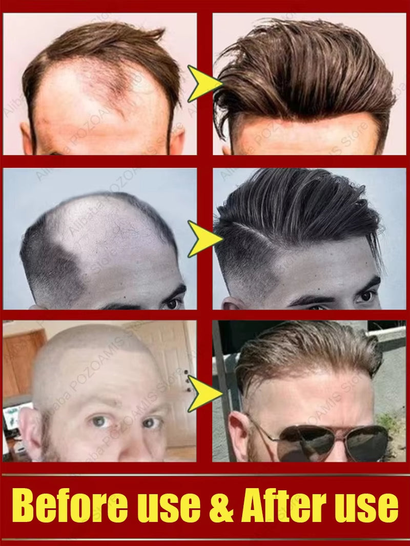 98% of Buyers Buy Again, Have More and More Hair, Say Goodbye to Baldness, Thick Hair,Hot Selling Product.