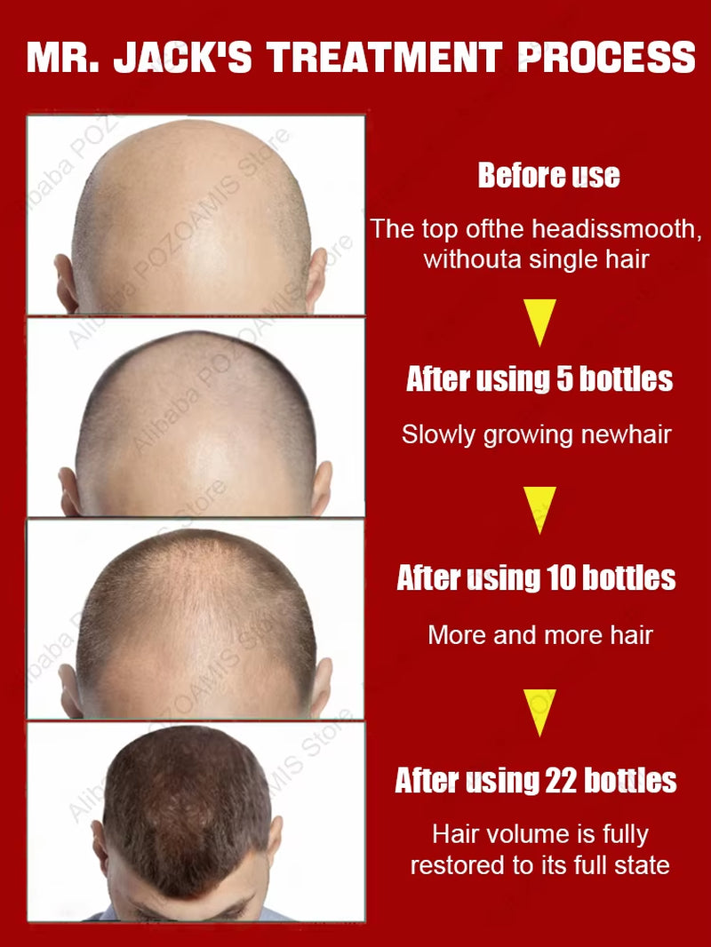 98% of Buyers Buy Again, Have More and More Hair, Say Goodbye to Baldness, Thick Hair,Hot Selling Product.